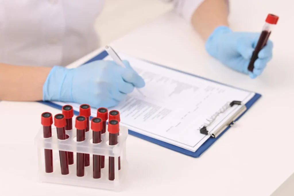 Basophils Levels in Blood Test