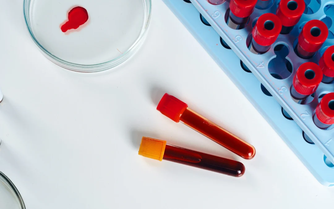 10 Essential Blood Tests for Early Disease Detection