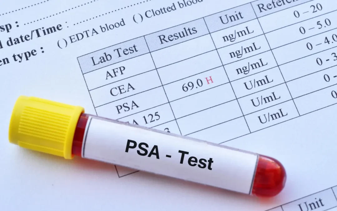 10 Key Questions About PSA Tests: A Comprehensive Guide for Men