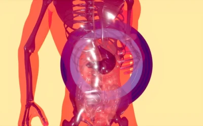Accessory Spleen: Understanding Its Hidden Role in Health and Disease