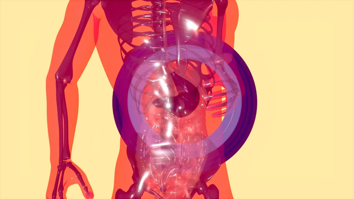 accessory spleen