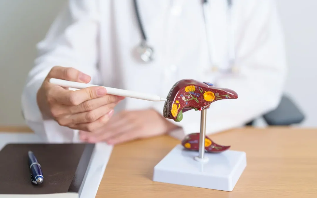 Liver Angiosarcoma: Understanding a Rare but Aggressive Cancer