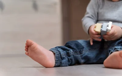 Ankle Hemangiomas: Diagnosis, Treatment, and the Nuanced Care They Demand